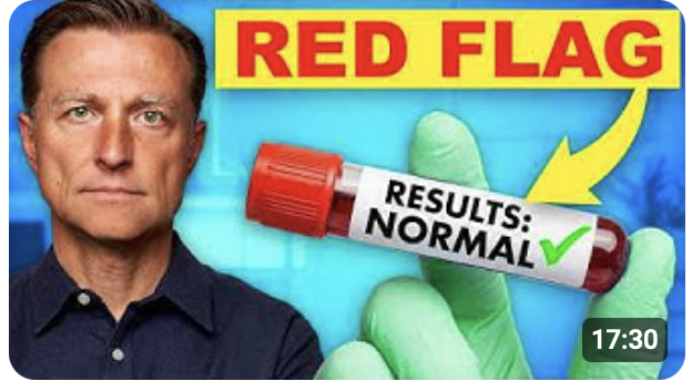 YouTube thumbnail sample